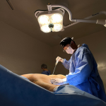 A Lipo HD difere da lipoaspiração tradicional e exige indicação criteriosa, destaca Milton Seigi Hayashi.